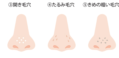 ③開き毛穴 ④たるみ毛穴 ⑤きめの粗い毛穴